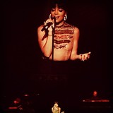 Lily Allen's stigmata claims