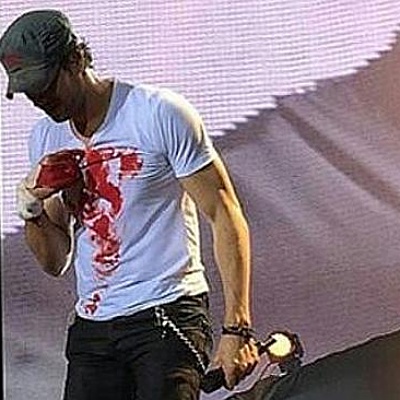 Enrique Iglesias injured by drone