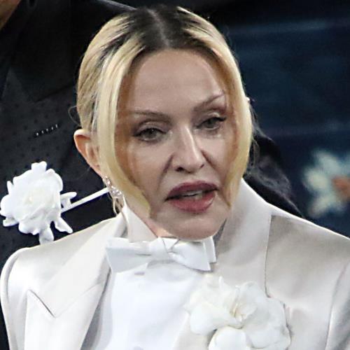 Madonna has ‘bad knee’ from dancing in high heels